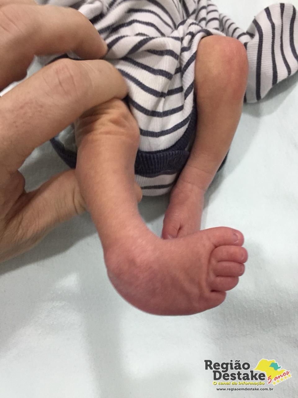 pe de bebe