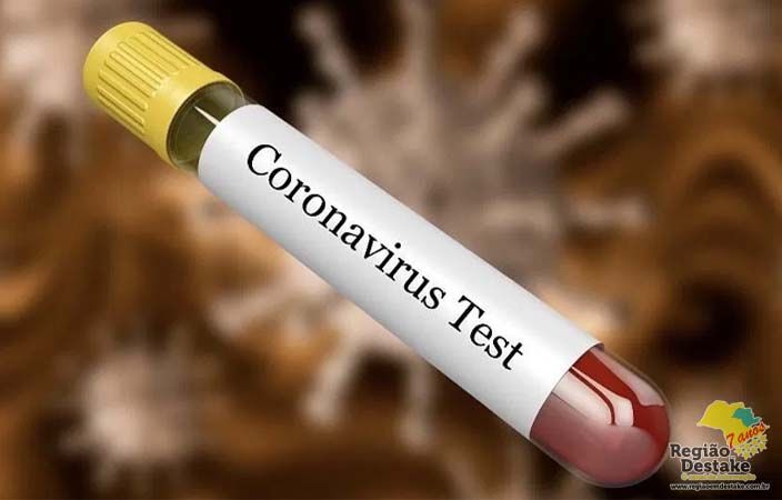 CORONAVIRUS-TEST