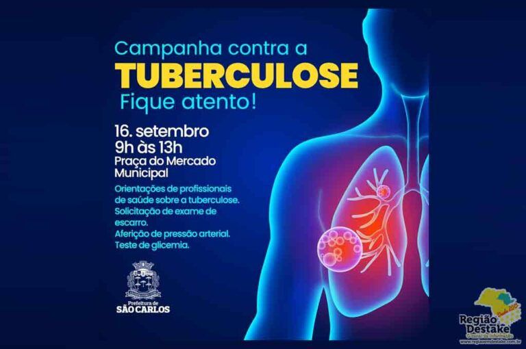 TUBERCULOSE