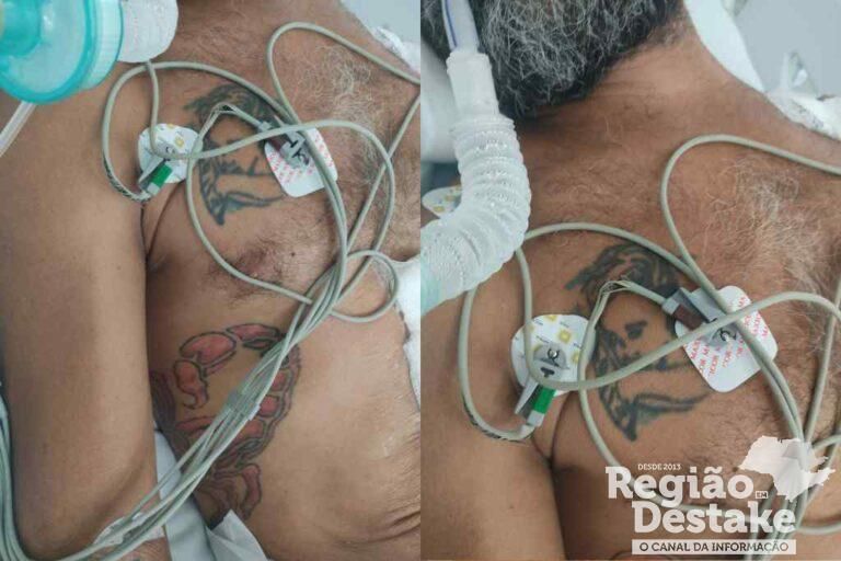 desconhecido