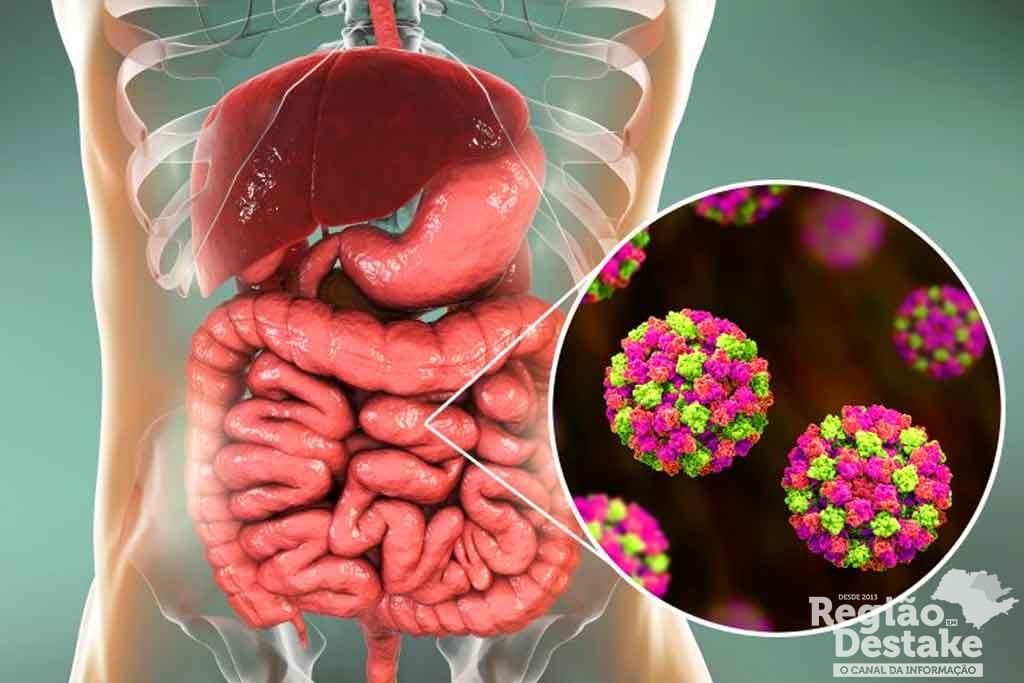 norovirus