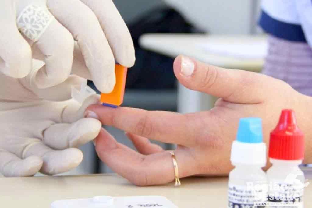 hiv